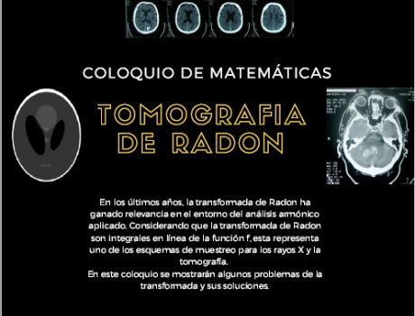 Tomografía de Radón